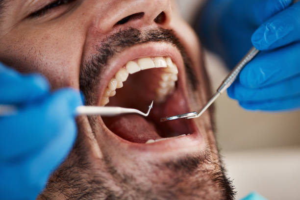 Emergency Dental Services in Bean Station, TN